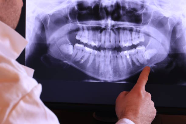 Trusted ID Emergency Dentist Experts